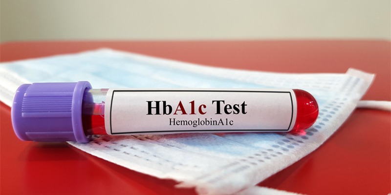 HBA1C Test