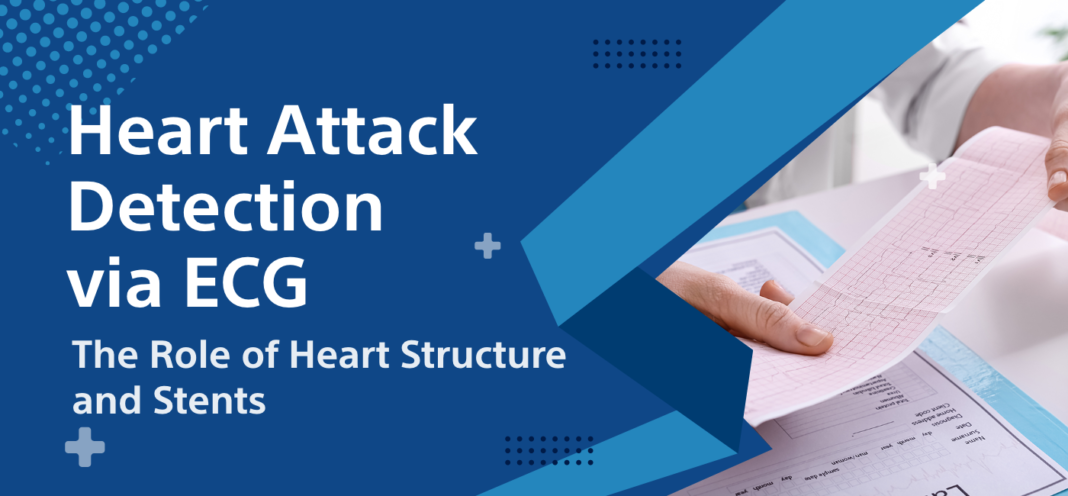 ECG Heart Attack, Structure of Human Heart, Coronary Stent