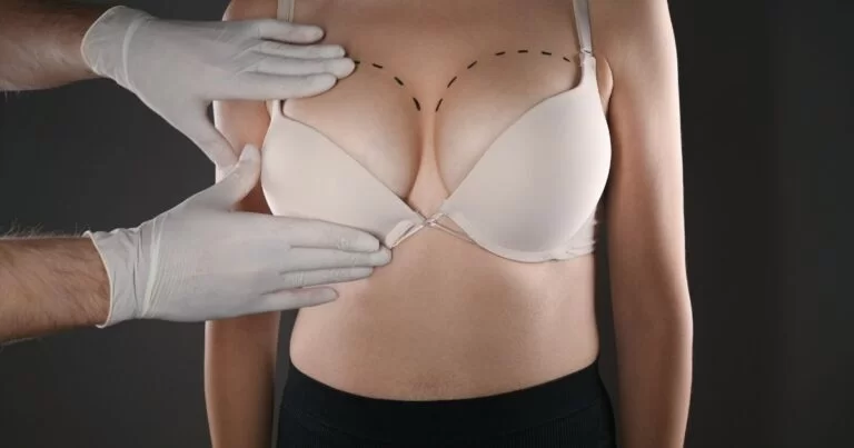 Breast Augmentation in Dubai What You Need to Know