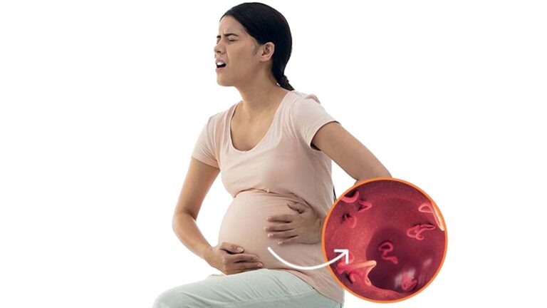 Is Albendazole safe for use during pregnancy? Is Albendazole safe for use during pregnancy?