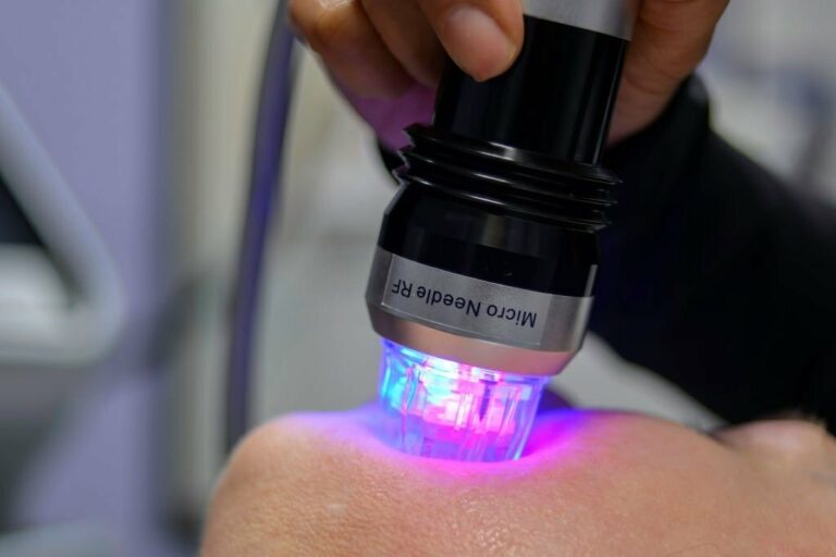 Permanent Makeup and RF Microneedling for Perfect Skin Permanent Makeup and RF Microneedling for Perfect Skin