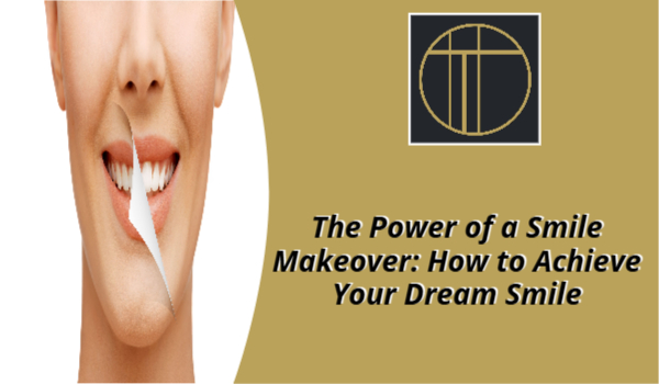 Smile Makeover
