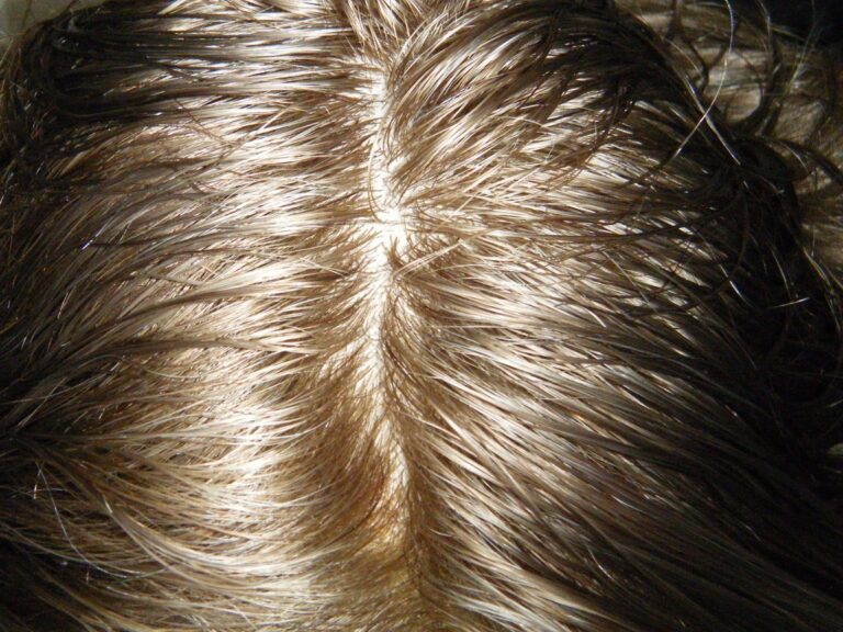 The 7 Secrets to the Most Undetectable Hair System The 7 Secrets to the Most Undetectable Hair System