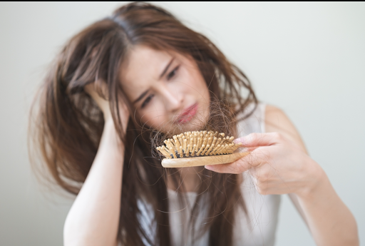 hair loss pcos