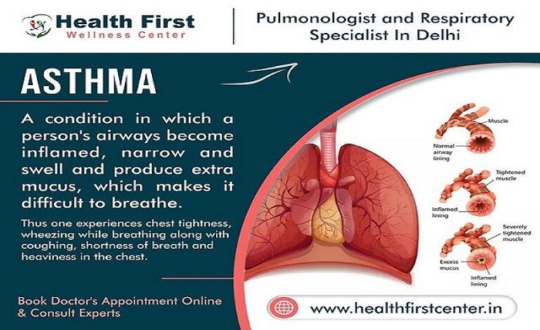 Asthma Specialist Doctor Near Me: Dr. Sanchayan Roy