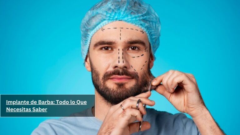Implante de Barba: Todo lo Que Necesitas Saber