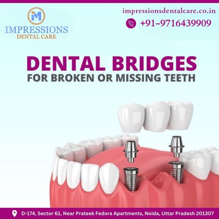 Best Dentist In Noida At Impressions Dental Care Best Dentist In Noida At Impressions Dental Care