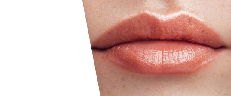 Botox Lippen und Lippenfüller: Was passt zu Ihnen Botox Lippen und Lippenfüller: Was passt zu Ihnen