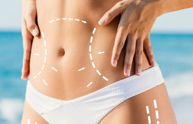 How to Find and Evaluate Reviews and Testimonials for Providers of Body Contouring in Dubai