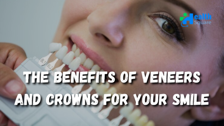 The Benefits of Veneers and Crowns for Your Smile