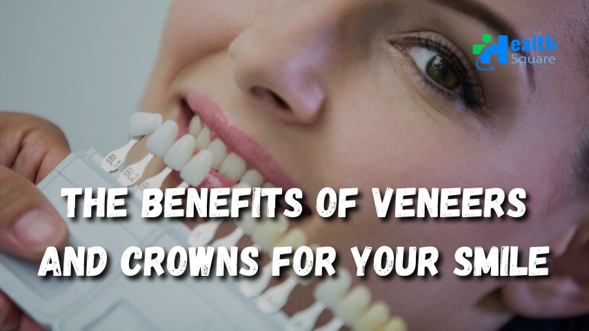 Veneers and Crowns