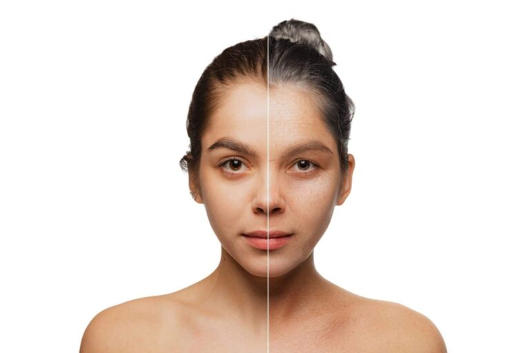 How to Choose the Right Anti-Aging Treatment for Your Skin Type How to Choose the Right Anti-Aging Treatment for Your Skin Type