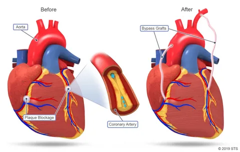 Heart Health